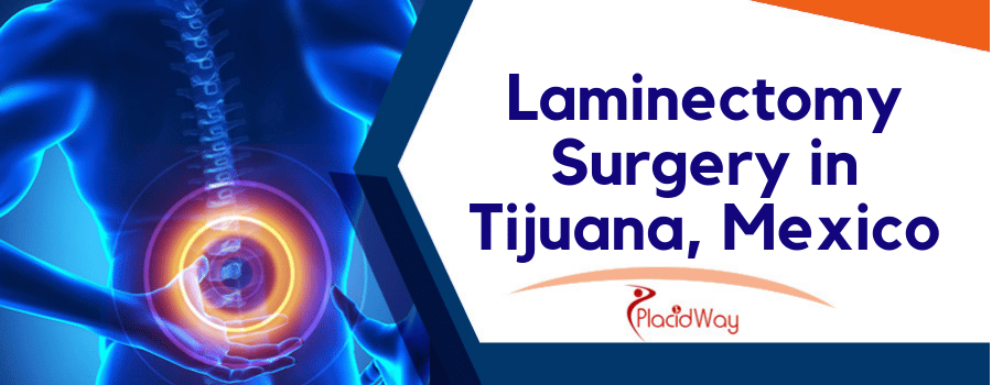 Laminectomy Surgery in Tijuana, Mexico